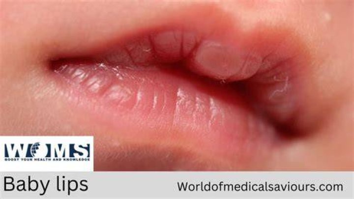 baby with big lips on ultrasound blackbodyart