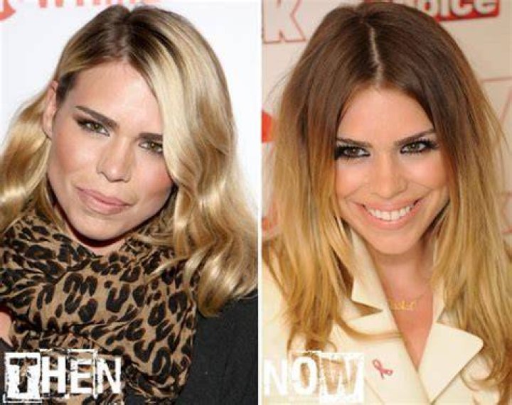 Billie Piper Plastic Surgery LearningJoan