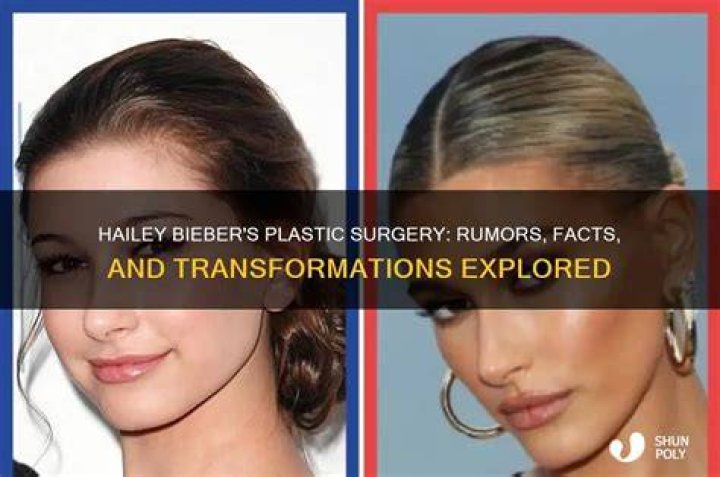 Hailey Bieber responds to plastic surgery rumor after &lsquo;crazy
