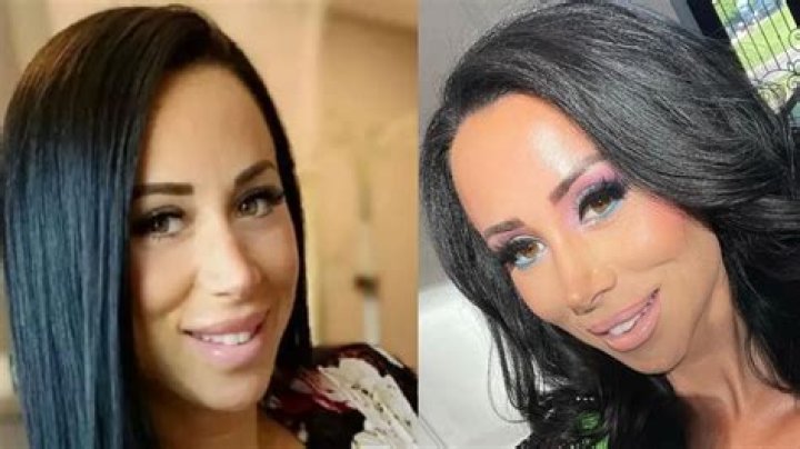 Rachel Fuda's Journey Before The Procedure