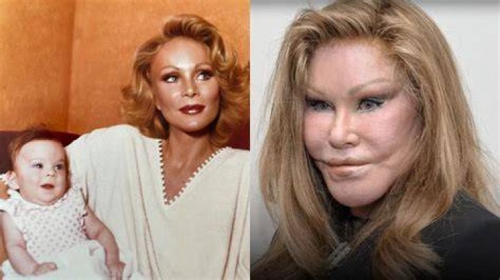 RealLife Cat Woman Jocelyn Wildenstein Celebrities Nigeria