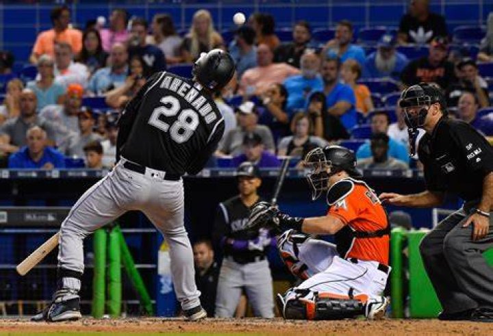 Rockies&rsquo; Nolan Arenado dodges broken hand, hopes he can avoid DL The