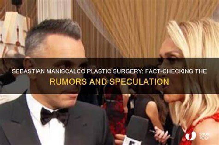 Sebastian Maniscalco&rsquo;s Plastic Surgery Did the 49YearOld Comedian