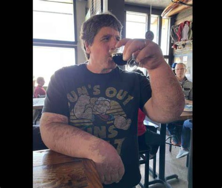 This Minnesota Man Has Very Large Arms and 1.1 Million TikTok Followers