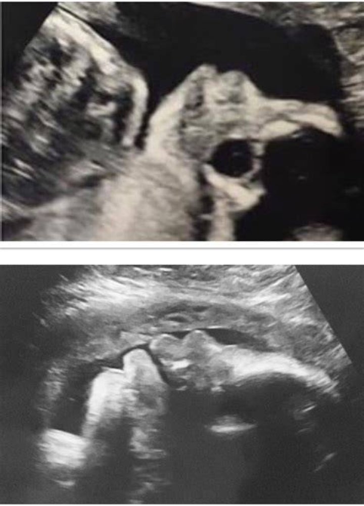 ultrasound (big lips) Glow Community